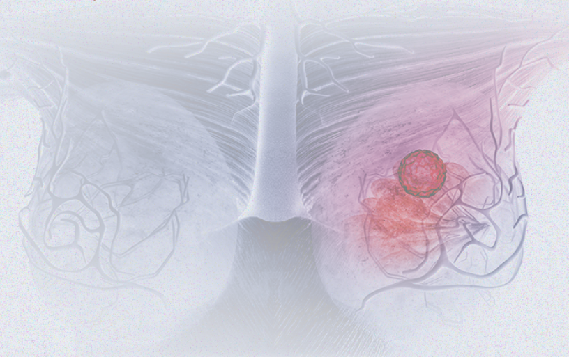 國際婦女節(jié) | 關(guān)注乳腺癌 微創(chuàng)介入讓美麗繼續(xù)，「乳」愿以償正成為現(xiàn)實(shí)